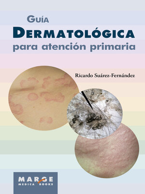 cover image of Guía dermatológica para atención primaria
